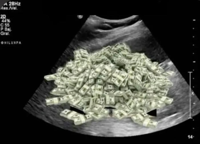 ảnh meme tiền cực hài hước